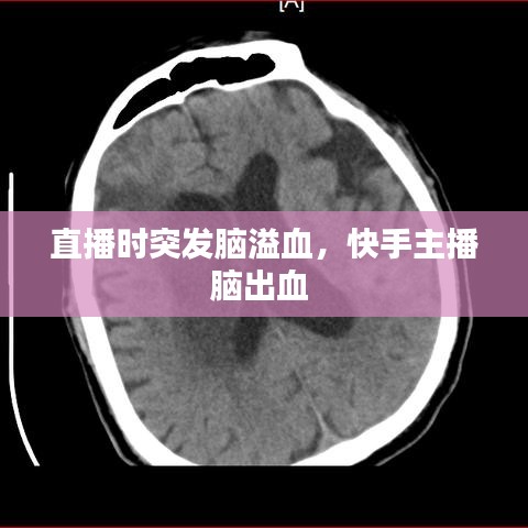 直播時突發(fā)腦溢血，快手主播腦出血 
