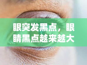 眼突發(fā)黑點，眼睛黑點越來越大 